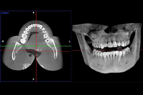 radio dentiste